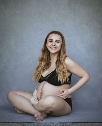 Hannah Witton