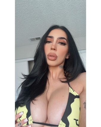 softnips_